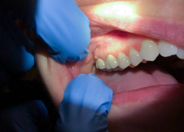 Best Pediatric Emergency Dentist in Justin, TX