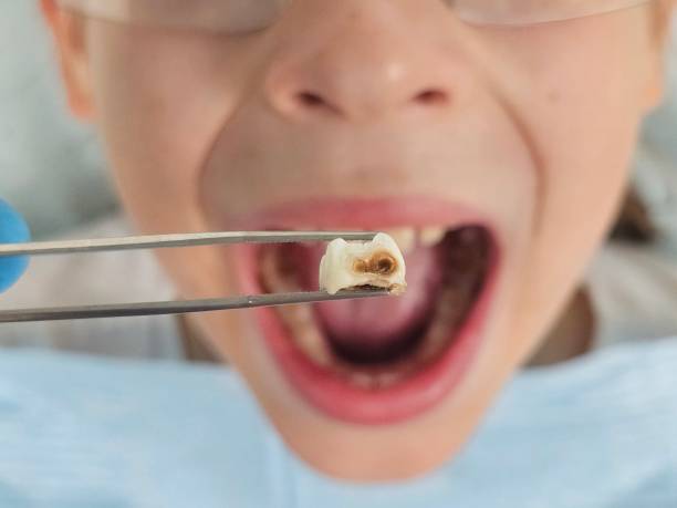 Best Weekend Emergency Dentist in Justin, TX