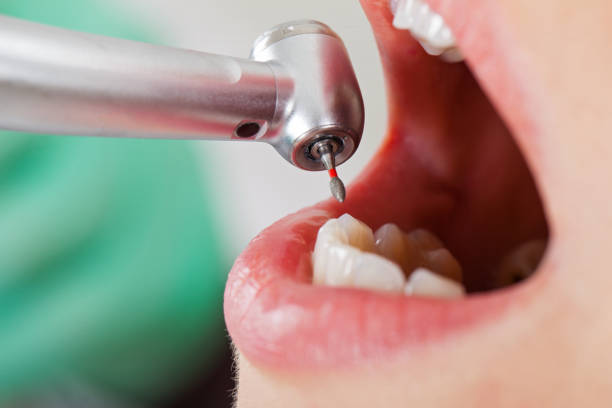Best Broken or Cracked Tooth Emergency Dentist in Justin, TX